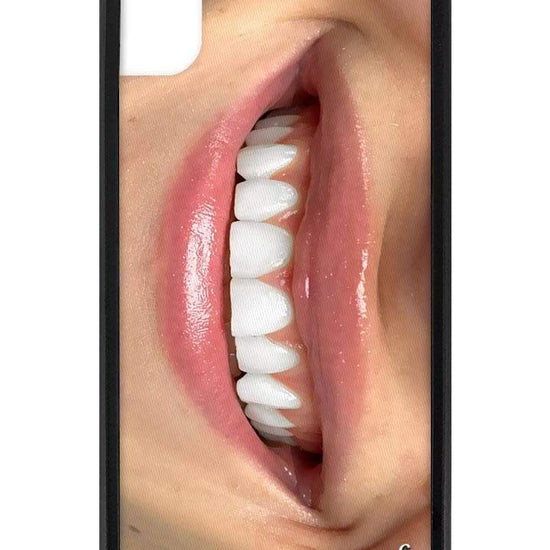 Devon Carlson Smile iPhone Xr Case